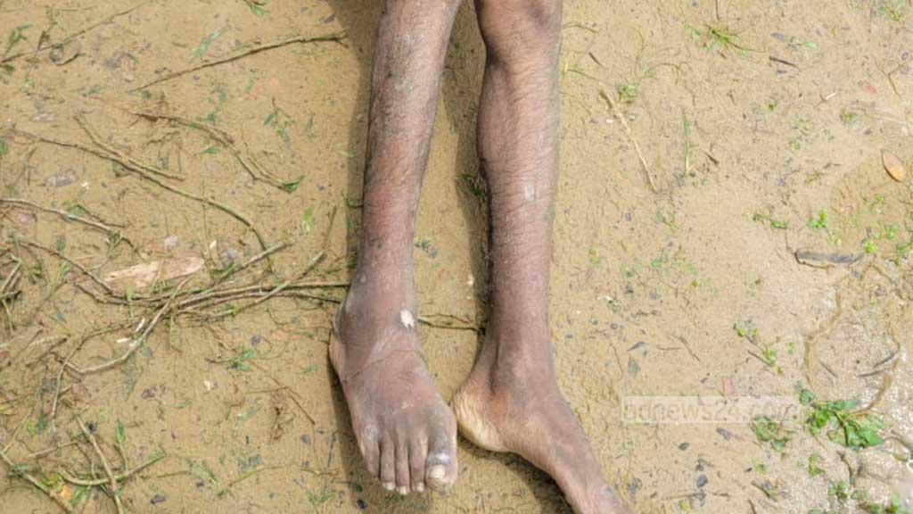 মাছের ঘেরে উপুড় হয়ে ভেসে ছিল লাশটি