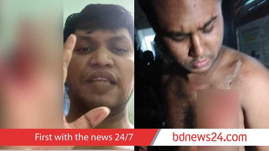 ঢাবিতে ভিপি প্রার্থী জালালের বিরুদ্ধে রুমমেটকে ছুরি মারার অভিযোগ, পাল্টা অভিযোগ তারও