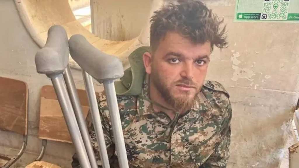 রকেটচালিত গ্রেনেডের শার্পনেলে আহত ২৭ বছর বয়সী আহমেদ। ছবি: বিবিসি