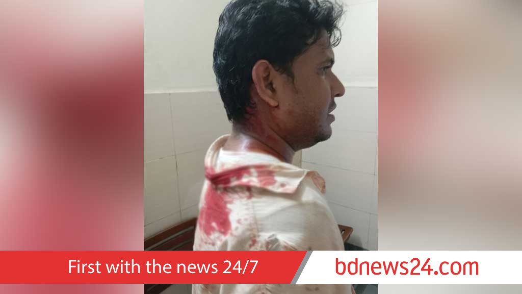 জঙ্গল সলিমপুরে হামলায় ২ সাংবাদিক আহত