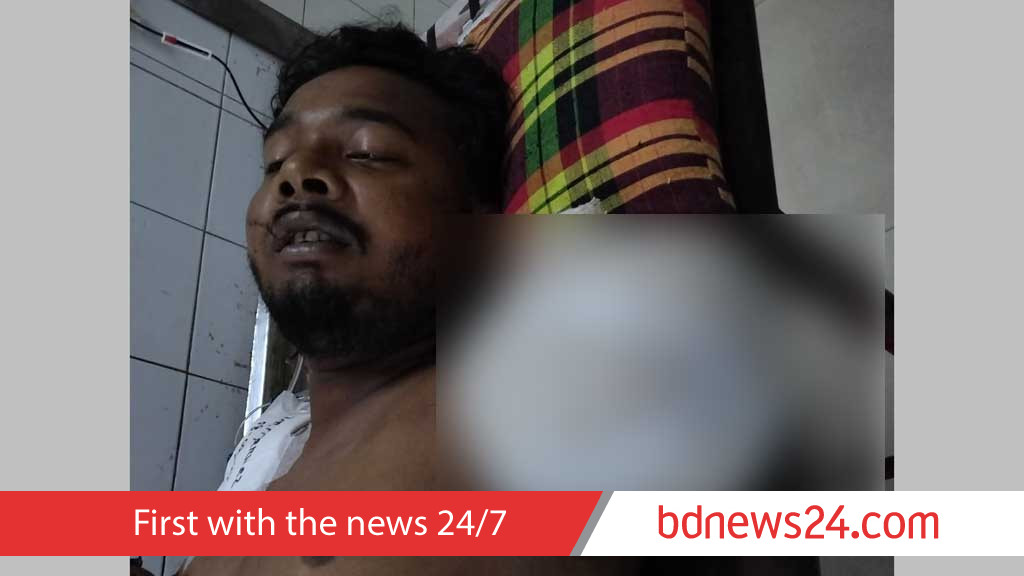 শুটিংয়ে যাওয়ার পথে দুর্ঘটনা, লাইটম্যান রবিন হাত হারালেন