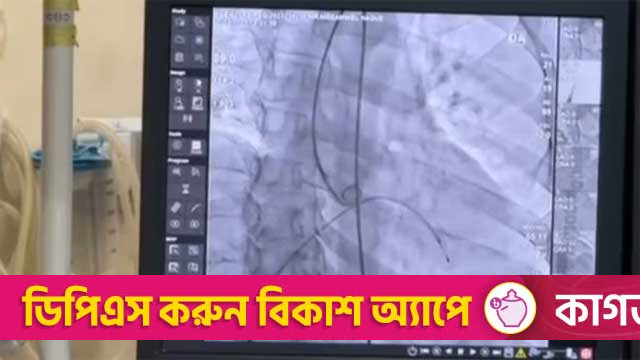 New prices for 10 types of heart stents to take effect from Oct 1