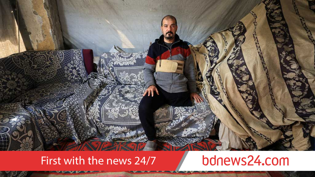 Gaza amputees short of prostheses under restrictions